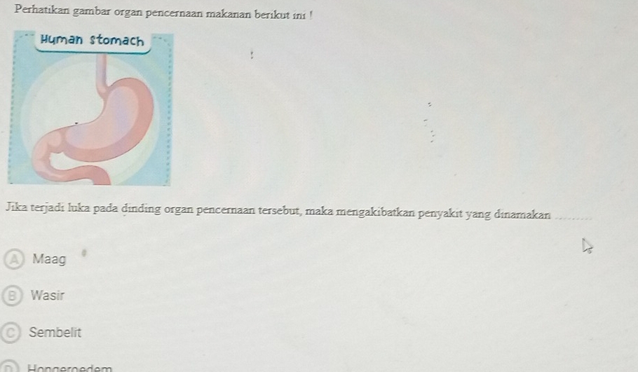 Perhatikan gambar organ pencernaan makanan berikut ini !
Jika terjadi luka pada dinding organ pencernaan tersebut, maka mengakibatkan penyakit yang dinamakan
A Maag
B) Wasir
C Sembelit
Höngergedem