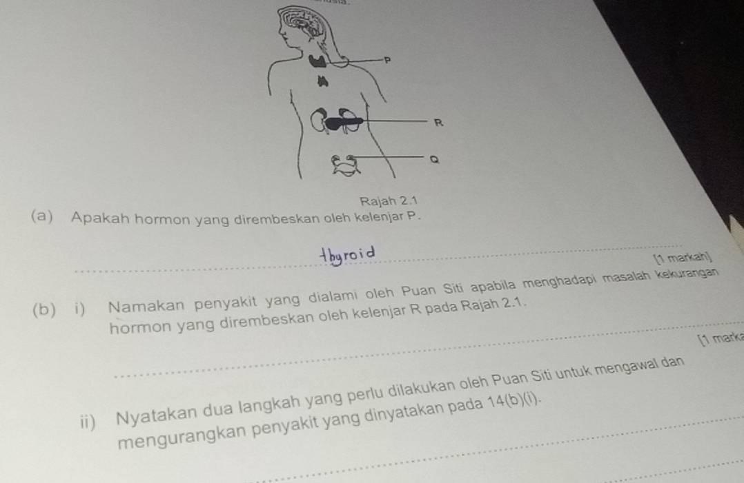 Apakah hormon yang dirembeskan oleh kelenjar P. 
[1 markah] 
(b) i) Namakan penyakit yang dialami oleh Puan Siti apabila menghadapi masalah kekurangan 
hormon yang dirembeskan oleh kelenjar R pada Rajah 2.1. 
[1 mark 
ii) Nyatakan dua langkah yang perlu dilakukan oleh Puan Siti untuk mengawal dan 
mengurangkan penyakit yang dinyatakan pada a 14(b)(i).