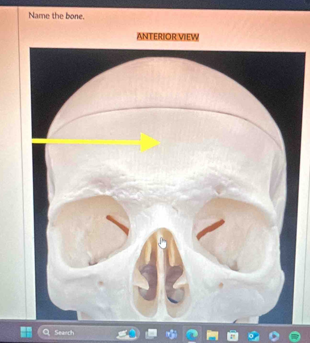 Name the bone. 
ANTERIOR VIEW 
Search