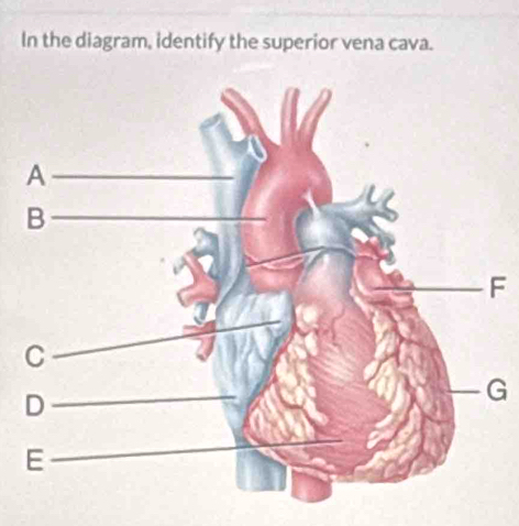 In the diagram, identify the superior vena cava.
F
G