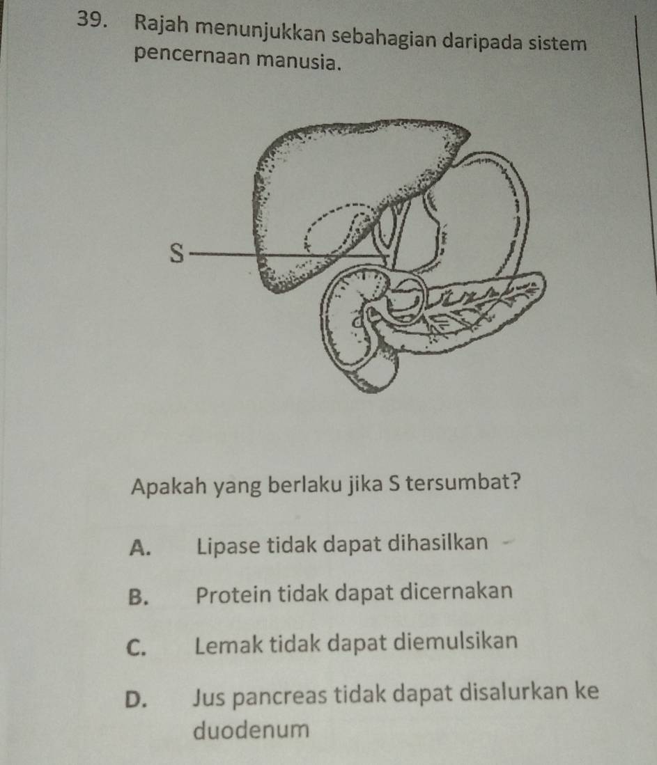 Rajah menunjukkan sebahagian daripada sistem
pencernaan manusia.
Apakah yang berlaku jika S tersumbat?
A. Lipase tidak dapat dihasilkan
B. Protein tidak dapat dicernakan
C. Lemak tidak dapat diemulsikan
D. Jus pancreas tidak dapat disalurkan ke
duodenum