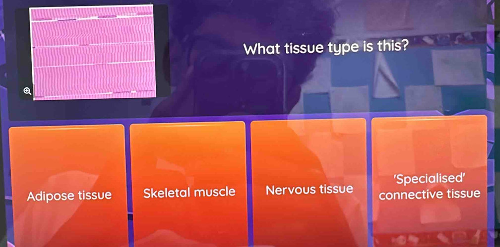 What tissue type is this?
Q
'Specialised'
Adipose tissue Skeletal muscle Nervous tissue connective tissue