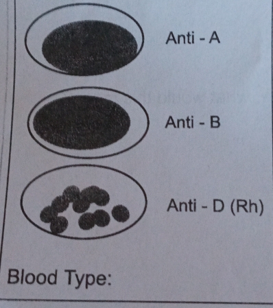 (Rh) 
Blood Type: