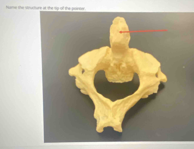 Name the structure