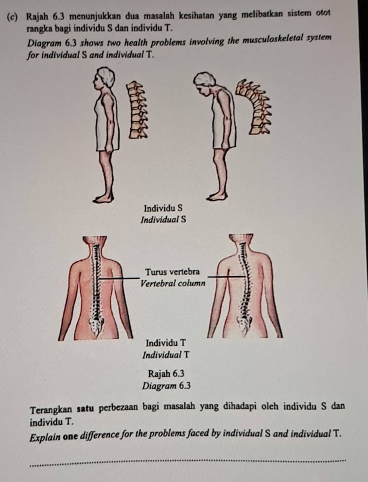 Rajah 6.3 menunjukkan dua masalah kesihatan yang melibatkan sistem otot 
rangka bagi individu S dan individu T. 
Diagram 6.3 shows two health problems involving the musculoskeletal system 
for individual S and individual T. 
Individu S 
Individual S 
Diagram 6.3 
Terangkan satu perbezaan bagi masalah yang dihadapi oleh individu S dan 
individu T. 
Explain one difference for the problems faced by individual S and individual T. 
_