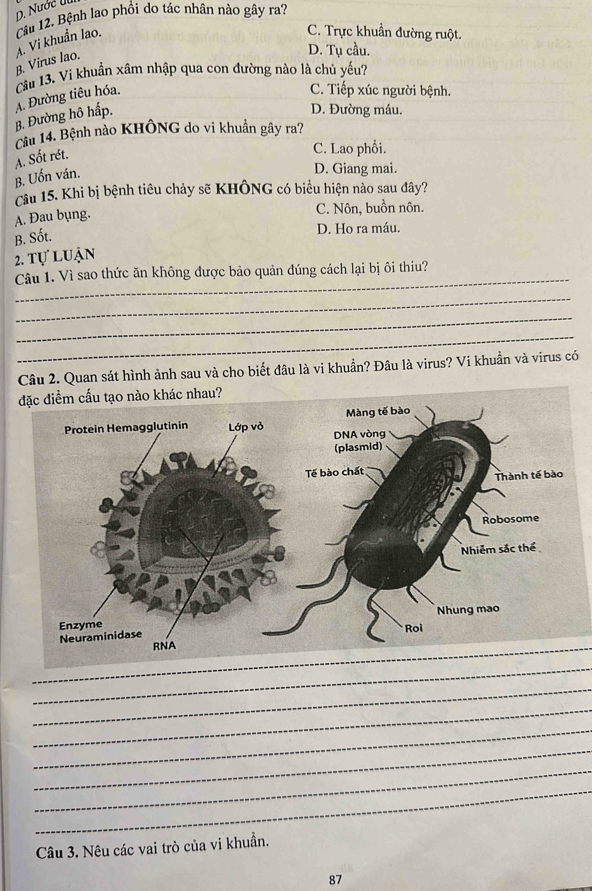 Nước U.
Câu 12. Bệnh lao phổi do tác nhân nào gây ra?
A. Vi khuẩn lao-
C. Trực khuẩn đường ruột.
B. Virus lao.
D. Tụ cầu.
Câu 13. Vi khuẩn xâm nhập qua con đường nào là chủ yếu?
A. Đường tiêu hóa.
C. Tiếp xúc người bệnh.
B. Đường hô hấp.
D. Đường máu.
Câu 14. Bệnh nào KHÔNG do vi khuẩn gây ra?
A. Sốt rét.
C. Lao phổi.
B. Uốn ván.
D. Giang mai.
Câu 15. Khi bị bệnh tiêu chảy sẽ KHÔNG có biểu hiện nào sau đây?
A. Đau bụng.
C. Nôn, buồn nôn.
B. Sốt.
D. Ho ra máu.
2. tự luận
_
Câu 1. Vì sao thức ăn không được bảo quản đúng cách lại bị ôi thiu?
_
_
_
Câu 2. Quan sát hình ảnh sau và cho biết đâu là vi khuẩn? Đâu là virus? Vi khuẩn và virus có
_RNA
_
_
_
_
_
_
_
Câu 3. Nêu các vai trò của vi khuẩn.
87