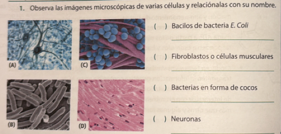 Observa las imágenes microscópicas de varias células y relaciónalas con su nombre, 
( ) Bacilos de bacteria E. Coli 
_ 
( ) Fibroblastos o células musculares 
_ 

( ) Bacterias en forma de cocos 
_ 
 )Neuronas 
_