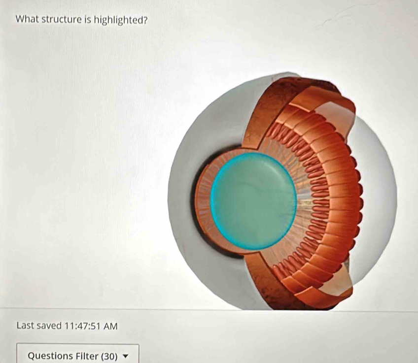 What structure is highlighted? 
Last saved 11:47:51 AM 
Questions Filter (30)