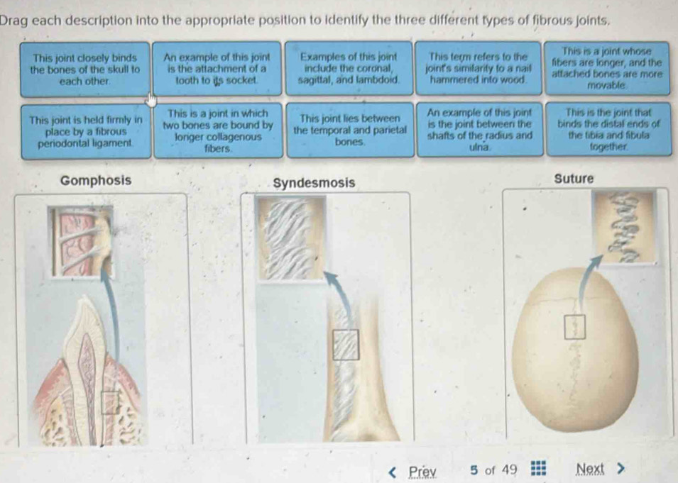 Solved: Drag each description into the appropriate position to identify ...