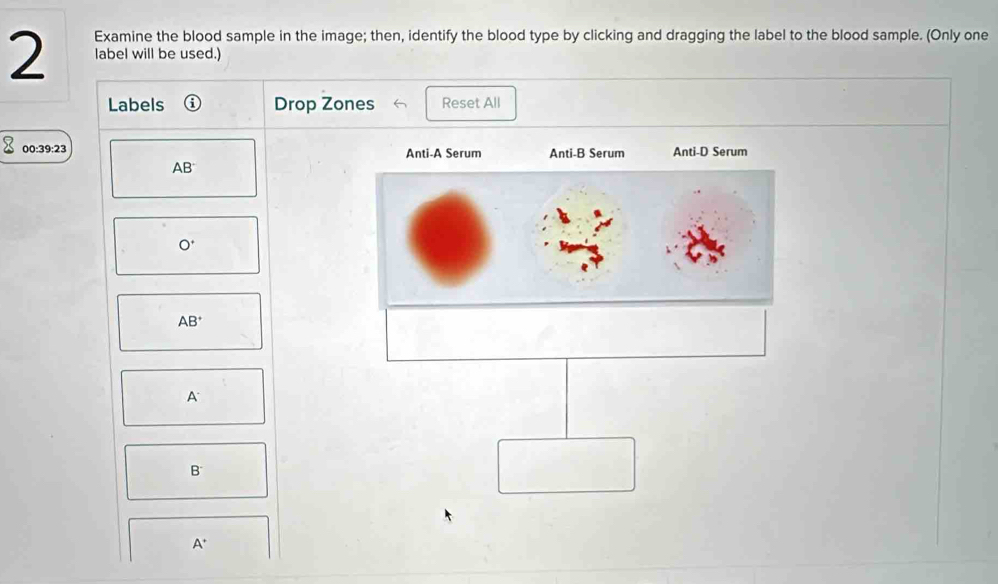 Solved: Examine the blood sample in the image; then, identify the blood ...