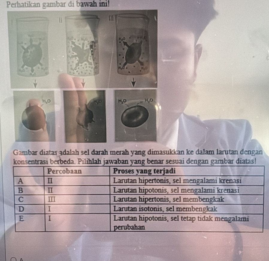 Perhatikan gambar di bawah ini! 
Gambar diatas adalah sel darah merah yang dimasukkan ke dalam larutan dengan 
konsentrasi berbeda. Pilihlah jawaban yang benar sesuai dengan gambar diatas!