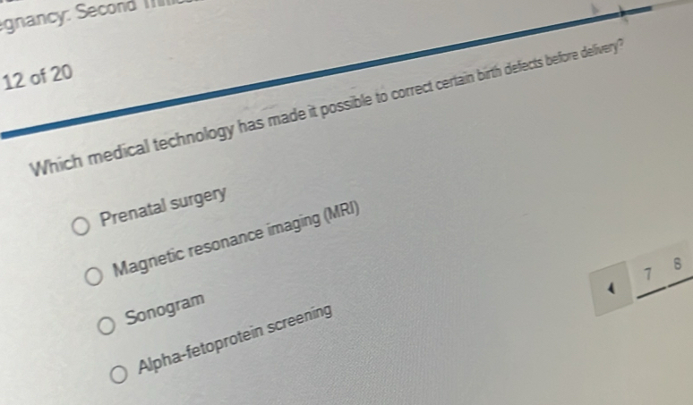 gnancy: Second III
12 of 20
Which medical technology has made it possible to correct certain birth defects before delivery
Prenatal surgery
Magnetic resonance imaging (MRI)
7 8
1
Sonogram
Alpha-fetoprotein screening
