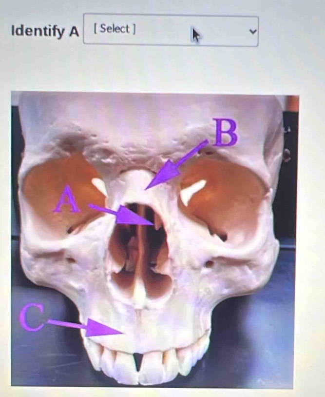 Identify A [ Select ]