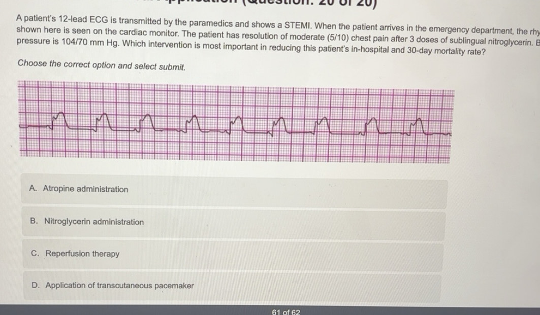 Solved: A patient's 12 -lead ECG is transmitted by the paramedics and ...