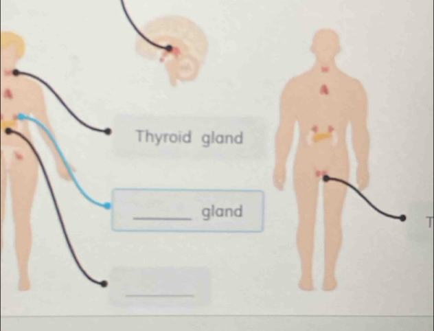 Thyroid gland 
_gland 

_