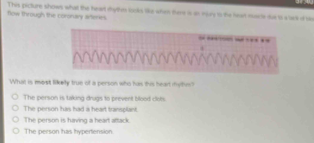 This picture shows what the theart ihytm lselks like when there is an injury is the heart muscle due io a lack of ble
flow through the coronary arteries.
What is most likely true of a person who has this heart mythm?
The person is taking drugs to prevent blood clots.
The person has had a heart transpllant.
The person is having a heart attack.
The person has hypertension.