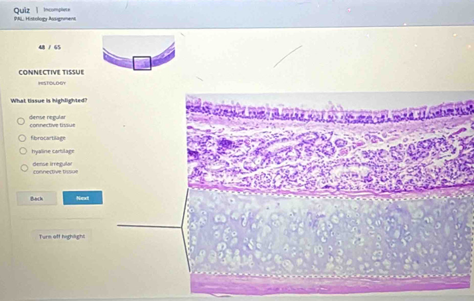 Quiz Incomplete
PAL: Histology Assignment
48 / 65
CONNECTIVE TISSUE
HISTOLOGY
What tissue is highlighted?
dense regular
connective tissue
fibrocartilage
hyaline cartilage
dense irregular
connective tissue
Back Next
_
Turn off highlight