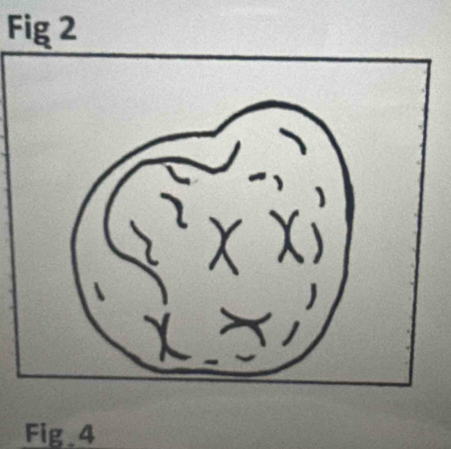 Fig 2 
Fig 4