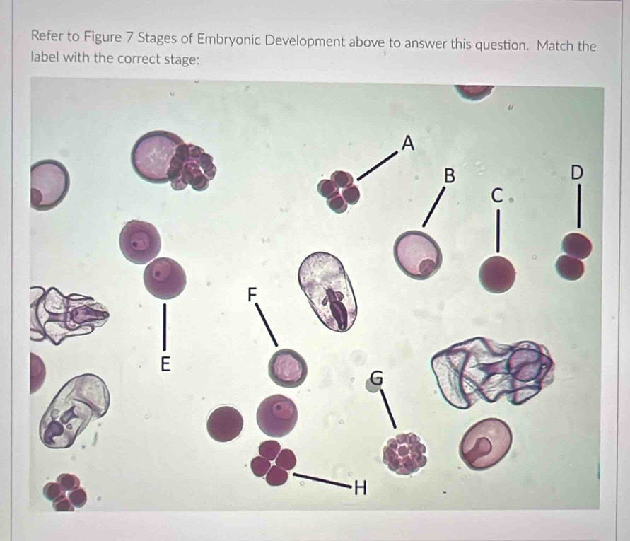 Refer to Figure 7 Stages of Embryonic Development above to answer this question. Match the 
label with the correct stage: