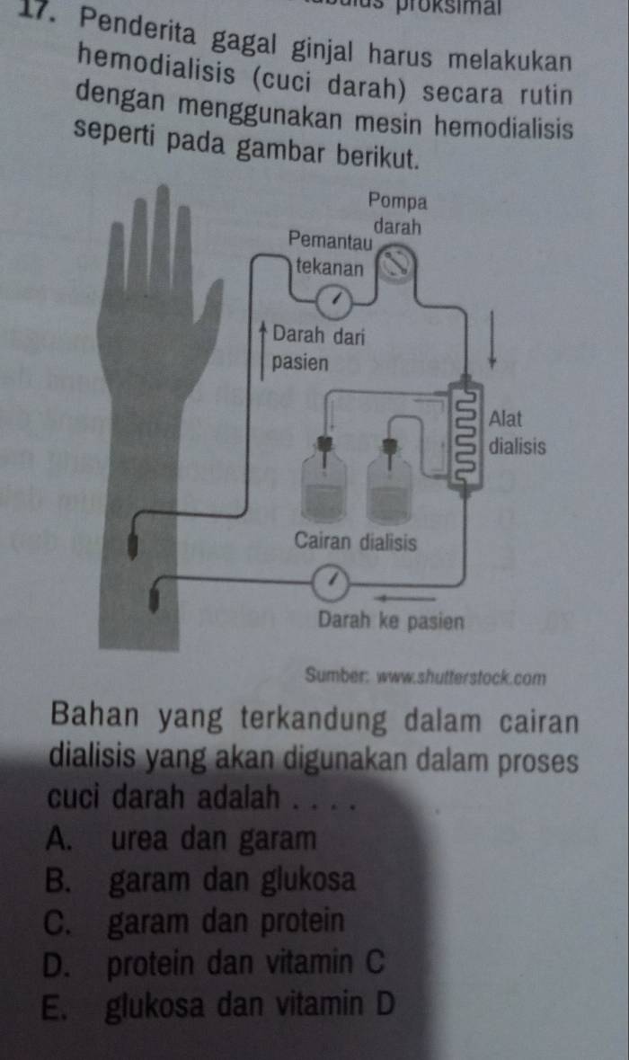 proksimal
17. Penderita gagal ginjal harus melakukan
hemodialisis (cuci darah) secara rutin
dengan menggunakan mesin hemodialisis
seperti pada gambar berikut.
Sumber: www.shutterstock.com
Bahan yang terkandung dalam cairan
dialisis yang akan digunakan dalam proses
cuci darah adalah . . . .
A. urea dan garam
B. garam dan glukosa
C. garam dan protein
D. protein dan vitamin C
E. glukosa dan vitamin D