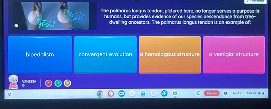 The palmarus longus tendon, pictured here, no longer serves a purpose in
humans, but provides evidence of our species descendance from tree-
dwelling ancestors. The palmarus longus tendon is an example of;
bipedalism convergent evolution a homologous structure a vestigial structure
VANESSA
Feb 11 7.49 Us