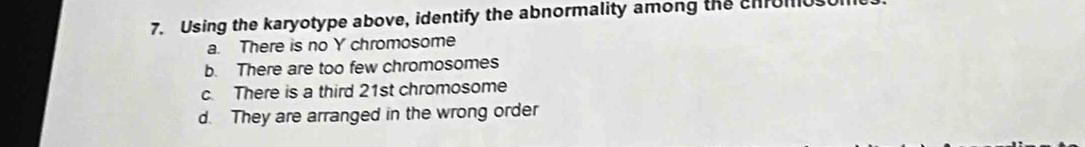 Using the karyotype above, identify the abnormality among the chrumo
a. There is no Y chromosome
b. There are too few chromosomes
c. There is a third 21st chromosome
d. They are arranged in the wrong order