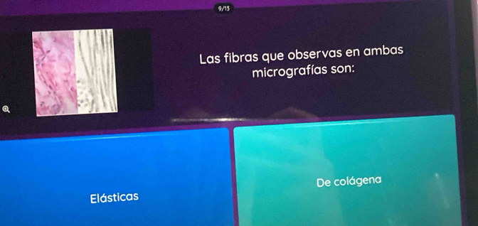 Las fibras que observas en ambas
micrografías son:
Elásticas De colágena