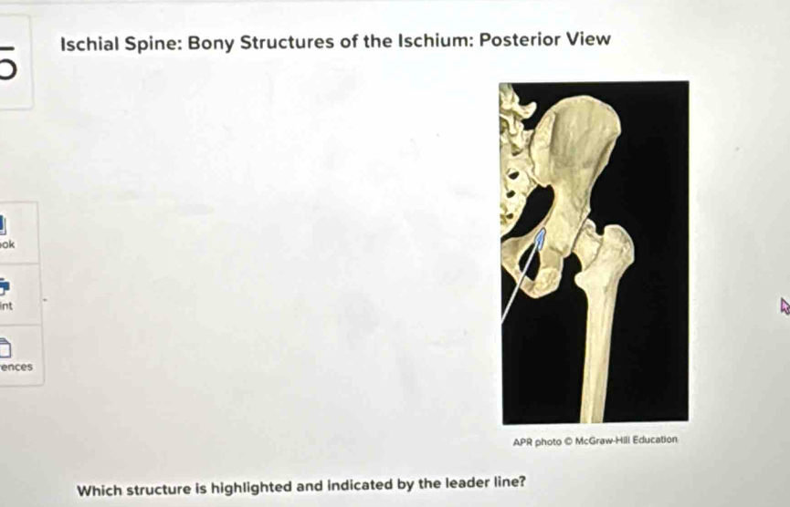 Ischial Spine: Bony Structures of the Ischium: Posterior View 
o 
int 
en 
APR photo © McGraw-Hill Education 
Which structure is highlighted and indicated by the leader line?