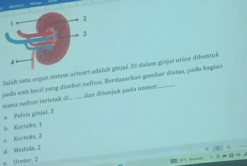 Salah satu organ sistem urinari adalah ginjal. Di dalam ginjal urine dibentuk
pada unit kecil yang disebut nefron. Berdasarkan gambar diatas, pada bagian
mana nefron terletak di... .....dan ditunjuk pada nomer
a. Pelvis ginjal, 3
b. Korteks, 1
c. Korteks, 2
d. Medula, 2
e. Ureter, 2
M°C Berawan