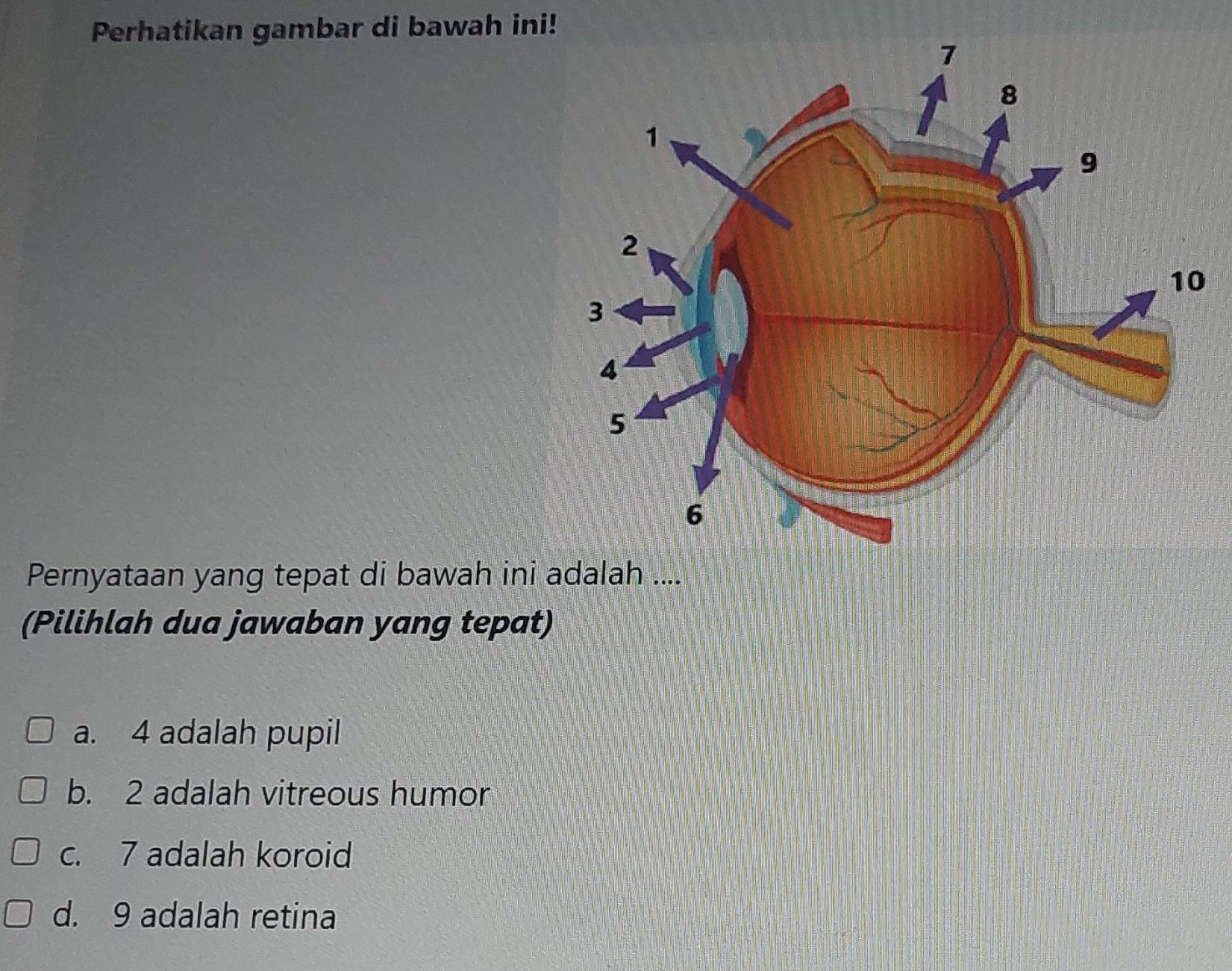 Perhatikan gambar di bawah ini!
Pernyataan yang tepat di bawah ini adalah ....
(Pilihlah dua jawaban yang tepat)
a. 4 adalah pupil
b. 2 adalah vitreous humor
c. 7 adalah koroid
d. 9 adalah retina