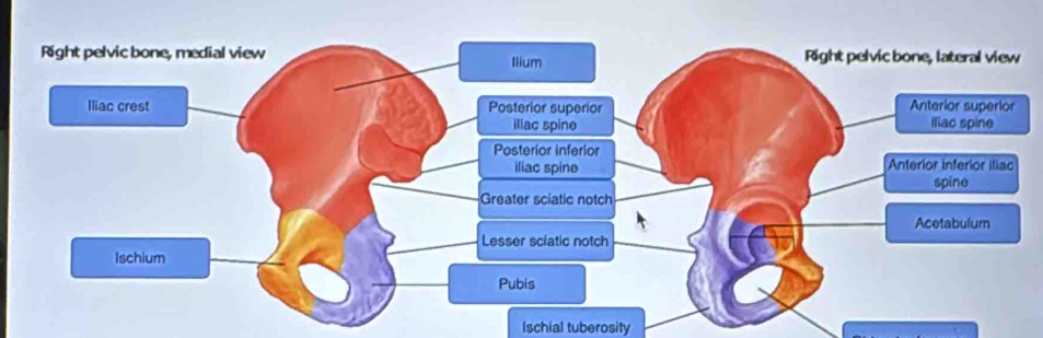 Ischial tuberosity