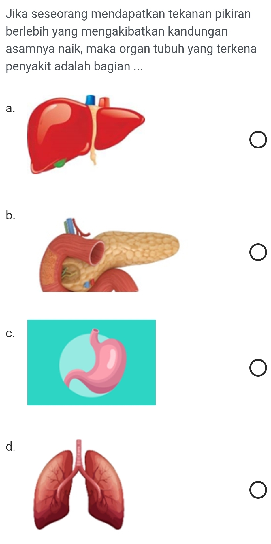 Jika seseorang mendapatkan tekanan pikiran 
berlebih yang mengakibatkan kandungan 
asamnya naik, maka organ tubuh yang terkena 
penyakit adalah bagian ... 
a. 
b. 
C. 
d.