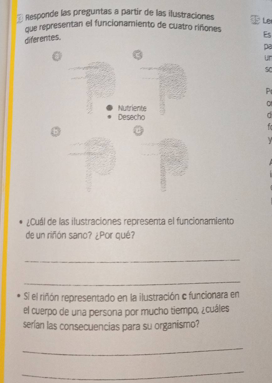 Responde las preguntas a partir de las ilustraciones 
Le 
que representan el funcionamiento de cuatro riñones 
diferentes. 
Es 
pa 
a 
un 
so 
P 
0 
C 
fo 
¿Cuál de las ilustraciones representa el funcionamiento 
de un riñón sano? ¿Por qué? 
_ 
_ 
Si el riñón representado en la ilustración c funcionara en 
el cuerpo de una persona por mucho tiempo, ¿cuáles 
serían las consecuencias para su organismo? 
_ 
_