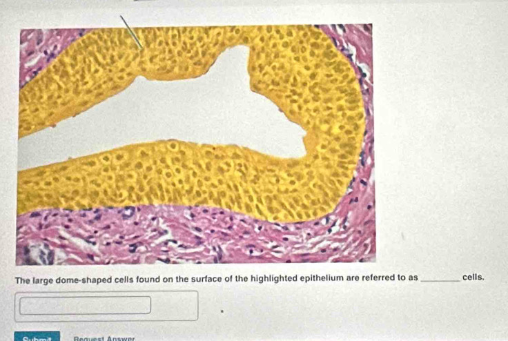 The large dome-shaped cells found on the surface of the highlighted epithelium are referred to as _cells.