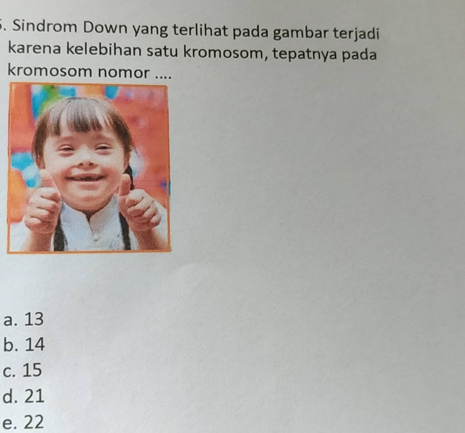 Sindrom Down yang terlihat pada gambar terjadi
karena kelebihan satu kromosom, tepatnya pada
kromosom nomor ....
a. 13
b. 14
c. 15
d. 21
e. 22