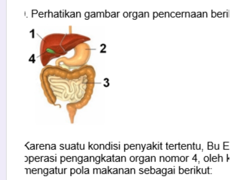 Perhatikan gambar organ pencernaan beril
4, oleh k
mengatur pola makanan sebagai berikut: