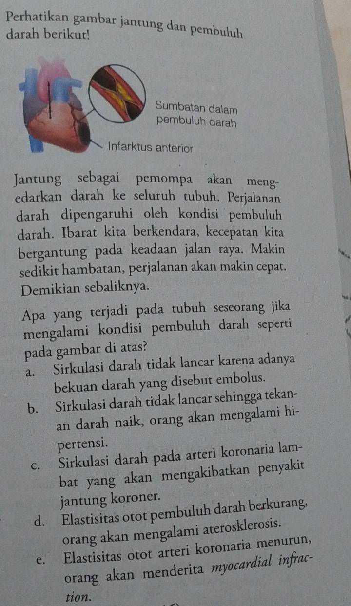 Perhatikan gambar jantung dan pembuluh
darah berikut!
Jantung sebagai pemompa akan meng-
edarkan darah ke seluruh tubuh. Perjalanan
darah dipengaruhi oleh kondisi pembuluh
darah. Ibarat kita berkendara, kecepatan kita
bergantung pada keadaan jalan raya. Makin
sedikit hambatan, perjalanan akan makin cepat.
Demikian sebaliknya.
Apa yang terjadi pada tubuh seseorang jika
mengalami kondisi pembuluh darah seperti
pada gambar di atas?
a. Sirkulasi darah tidak lancar karena adanya
bekuan darah yang disebut embolus.
b. Sirkulasi darah tidak lancar sehingga tekan-
an darah naik, orang akan mengalami hi-
pertensi.
c. Sirkulasi darah pada arteri koronaria lam-
bat yang akan mengakibatkan penyakit
jantung koroner.
d. Elastisitas otot pembuluh darah berkurang,
orang akan mengalami aterosklerosis.
e. Elastisitas otot arteri koronaria menurun,
orang akan menderita myocardial infrac-
tion.