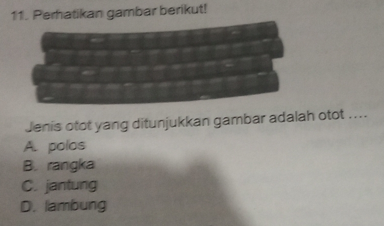 Perhatikan gambar berikut!
Jenis otot yang ditunjukkan gambar adalah otot ....
A. polos
B. rangka
C. jantung
D. lambung