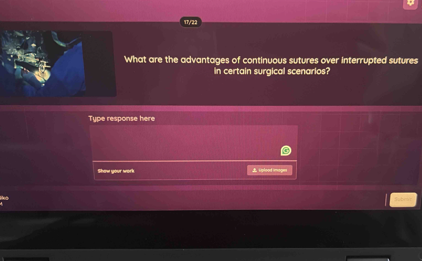 17/22 
hat are the advantages of continuous sutures over interrupted sutures 
in certain surgical scenarios? 
Type response here 
Show your work Upload images 
liko Submit