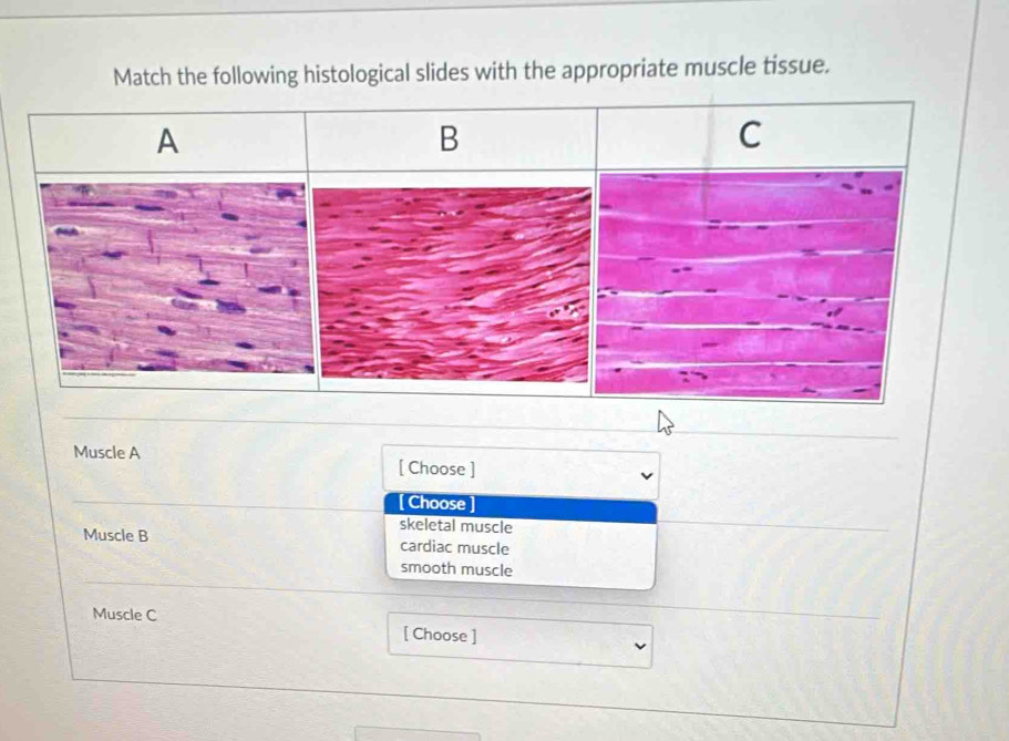 Solved: Match the following histological slides with the appropriate ...