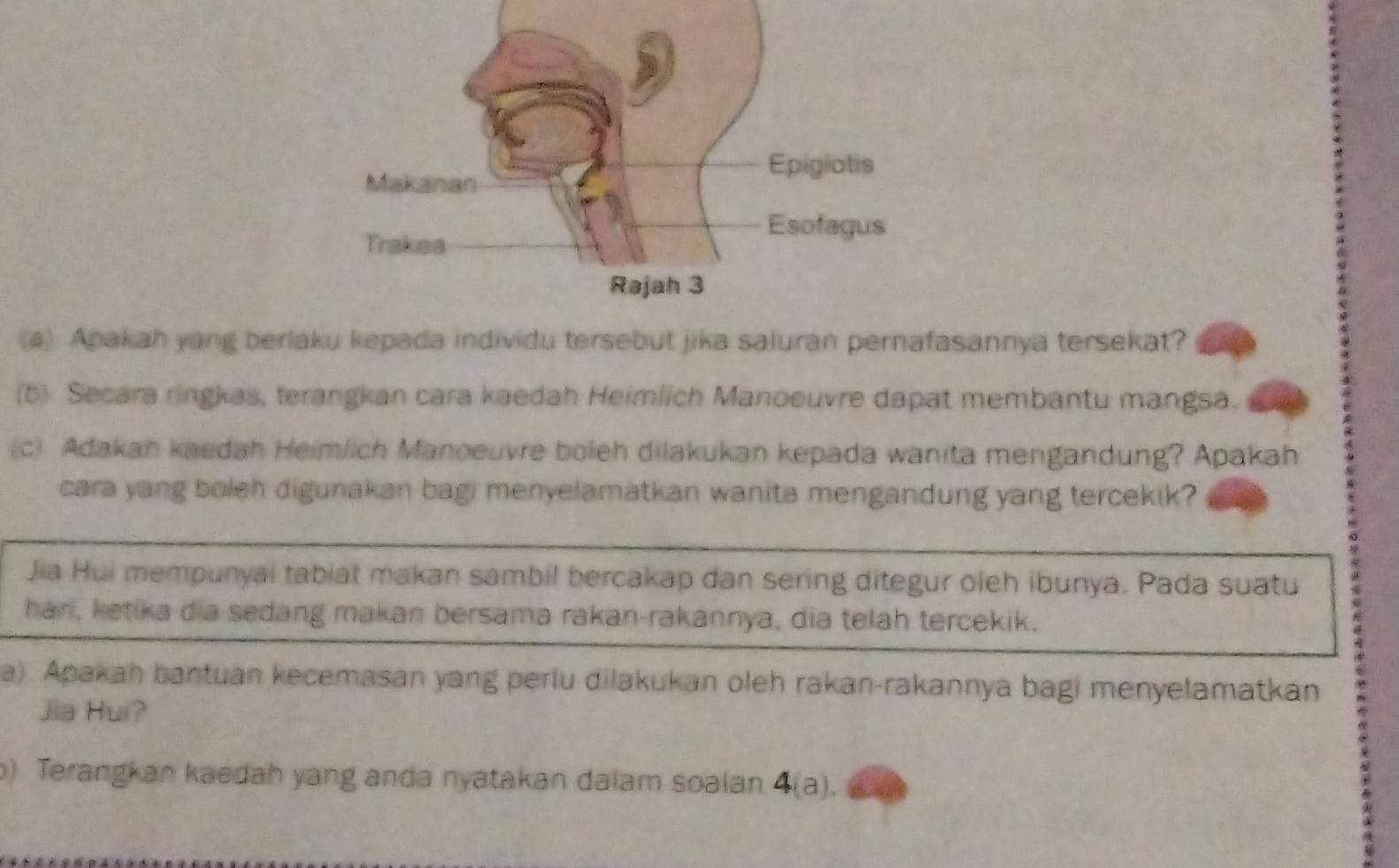 Apakah yang berlaku kepada individu tersebut jika saluran pernafasannya tersekat? 
(b) Secara ringkas, terangkan cara kaedah Heimlich Manoeuvre dapat membantu mangsa. 
(c) Adakan kaedah Heimlich Manoeuvre boleh dilakukan kepada wanita mengandung? Apakah 
cara yang boleh digunakan bagi menyelamatkan wanita mengandung yang tercekik? 
Jia Hui mempunyai tabiat makan sambil bercakap dan sering ditegur oleh ibunya. Pada suatu 
han, ketika dia sedang makan bersama rakan-rakannya, dia telah tercekik. 
8 
a). Apakan bantuan kecemasan yang perlu dilakukan oleh rakan-rakannya bagi menyelamatkan 
Jia Hui? 
) Terangkan kaedah yang anda nyatakan dalam soalan 4(a).