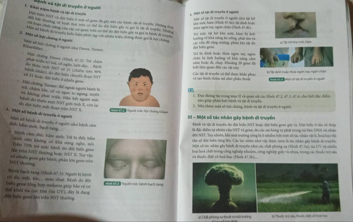 Bệnh và tật di truyền ở người
1. Khái niệm bệnh và tật di truyền
4. Một số tật di truyền ở người
Một số tật di truyền ở người như tật hở
Đột biến NST và đột biển ở một số gene đã gây nên các bệnh, tật di truyền. Những that thừa ngón tay, ngón chân (Hình 47.4b).
khe môi, hàm (Hình 47.4a); tật đính hoặc 
đổi bất thường về hình thái trên cơ thể đo đột biển gây ra gọi là tật di truyền. Những
rới loạn chức năng của các cơ quan trên cơ thể do đột biến gây ra gọi là bệnh đi truyền
Trẻ mắc tật hở khe môi, hàm bị ảnh
Một số bệnh đi truyền biểu hiện phức tạp với nhiều triệu chứng được gọi là hội chứng
2. Một số hội chứng ở người
hưởng về khả năng ăn uống, phát âm và
các vấn để răng miệng: phần lớn tật do a) Tật hở khe môi, hàm
Một số hội chứng ở người như Down, Turner,
Klinefelter,
đột biến gene.
Trẻ bị dính hoặc thừa ngón tay, ngó
- Hội chứng Down (Hình 47.2): Trẻ chậm
chân bị ảnh hưởng về khả năng cầ
nâm hoặc đi, chạy. Khoảng 20 gene 
phát triển trí tuệ, cổ ngăn, lưỡi dày,.. Bệnh
biết liên quan đến các tật này.
do thừa một NST số 21 (chiếm trên 90%
Các tật di truyền có thể được khắc phục b) Tật dinh hoặc thừa ngón tay, ngôn chân
bệnh nhân), do đột biến chuyển đoạn NST
số 21 hoặc đột biến ở nhiều gene.
và tạo hình thẩm mĩ nhờ phẫu thuật.  Tmh tể t Một số tật di truyền ở người
Hội chứng Turner: Bể ngoài người bệnh là
7
nữ, chậm lớn, cổ và ngực to ngang, tuyến
1. Đọc thông tin trong mục II và quan sát các Hình 47.2, 47.3, 47.4, cho biết đặc điểm
vú không phát triển. Hầu hết người mắc
nào giúp phân biệt bệnh và tật di truyền.
bệnh do thiếu một NST giới tính X, còn lại
2. Nêu thêm một số hội chứng, bệnh và tật di truyền ở người.
do đột biến mắt đoạn trên NST X. Timi  t Người mắc hội chứng Down
3. Một số bệnh di truyền ở người
III - Một số tác nhân gây bệnh di truyền
Một số bệnh di truyền ở người như bệnh cảm
Bệnh và tật di truyền do đột biến NST hoặc đột biến gene gây ra. Đột biển ở tấn số thấp
điếc bẩm sinh, bạch tạng.
là đặc điểm tự nhiên của NST và gene, do các sai hồng tự phát trong tải bản DNA và nhân
Bệnh câm điếc bẩm sinh: Trẻ bị điếc bẩm
đôi NST. Tuy nhiên, khi môi trường sống bị ô nhiễm bởi một số tác nhân vật lí, hoá học thị
tấn số đột biến tăng lên. Các tác nhân như vậy được xem là tác nhân gây bệnh di truyền.
sinh nên khōng có khả năng nghe, nói.
Một số tác nhân gây bệnh di truyền như các chất phóng xạ (Hình 47.5a), tia UV và nhiều
Trên 75% trẻ mắc bệnh do đột biến gene
loại hoá chất trong công nghiệp nhuộm, công nghiệp giấy và nhựa, trong các thuốc trừ sâu
lận trên NST thường hoặc NST X. Tuy vậy,
và thuốc diệt cỏ hoá học (Hình 47.5b),...
có nhiều gene gây bệnh, phần lớn gene trên
NST thường.
Bệnh bạch tạng (Hình 47.3): Người bị bệnh
có da, mắt, tóc,... màu nhạt. Bệnh do đột N nh   Người mắc bệnh bạch tạng
biến gene tổng hợp melanin giúp bảo vệ cơ
thể khỏi tìa cực tím (tia UV), đây là dạng
đột biến gene lận trên NST thường.
a) Chất phóng xạ thoát ra môi trường b) Thuốc trừ sâu, thuốc diệt có hoà học