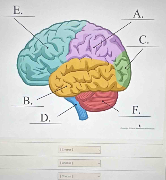 [ Choose ) 
[ Choose ] 
[ Choose ]