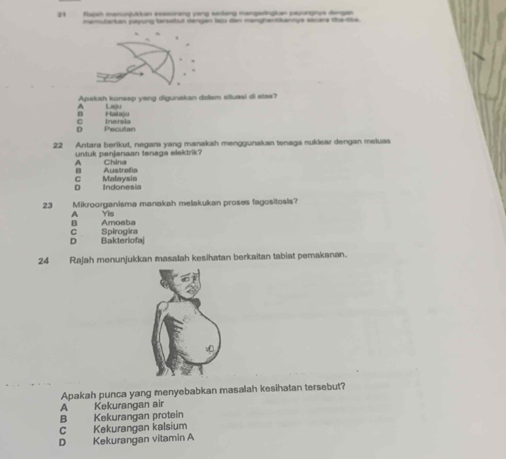 Fajsh manunjkn exssonang yang sakeng mangetingian payngnys dengen
memutarkan paying tersatul dengan laju dan manghentikannys stsara the-lhe.
.
*
Apakah konsep yang digunakan dalam situasi di atas?
A Laju
B Halaju
C Inersia
D Pecutan
22 Antara berikut, negara yang manakah menggunakan tenaga nuklear dengan meluas
untuk penjanaan tenaga elektrik?
A China
B Australia
C Malaysia
D Indonesia
23 Mikroorganisma manakah melakukan proses fagositosis?
A Yis
B Amoeba
C Spirogira
D Bakteriofaj
24 Rajah menunjukkan masalah kesihatan berkaitan tabiat pemakanan.
Apakah punca yang menyebabkan masalah kesihatan tersebut?
A Kekurangan air
B Kekurangan protein
C Kekurangan kalsium
D Kekurangan vitamin A