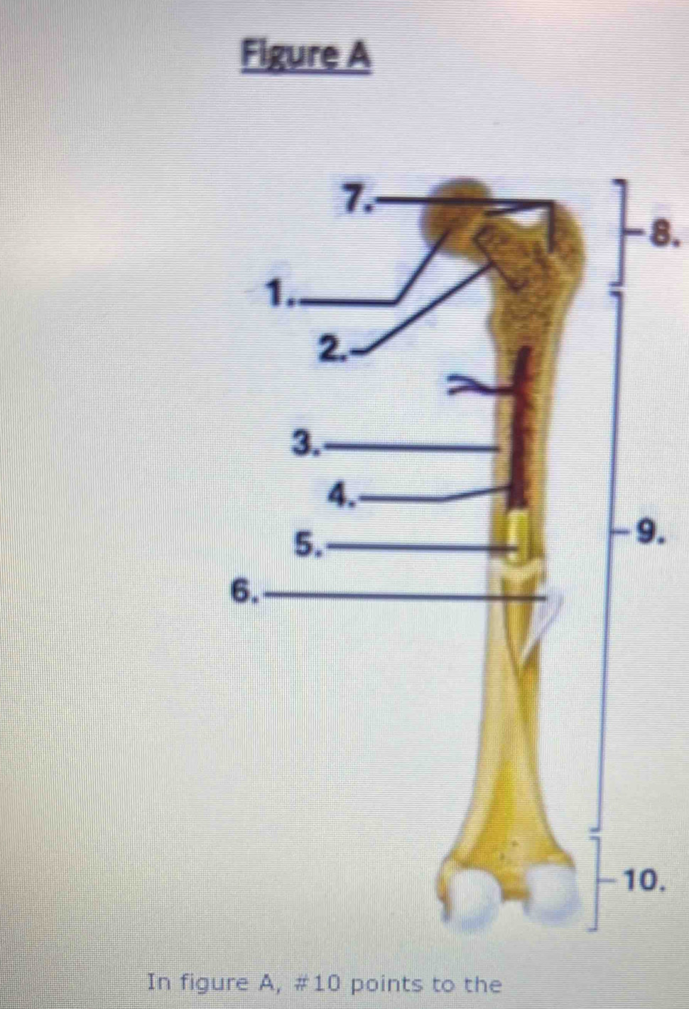 Figure A
8.
9.
0.
In figure A, #10 points to the