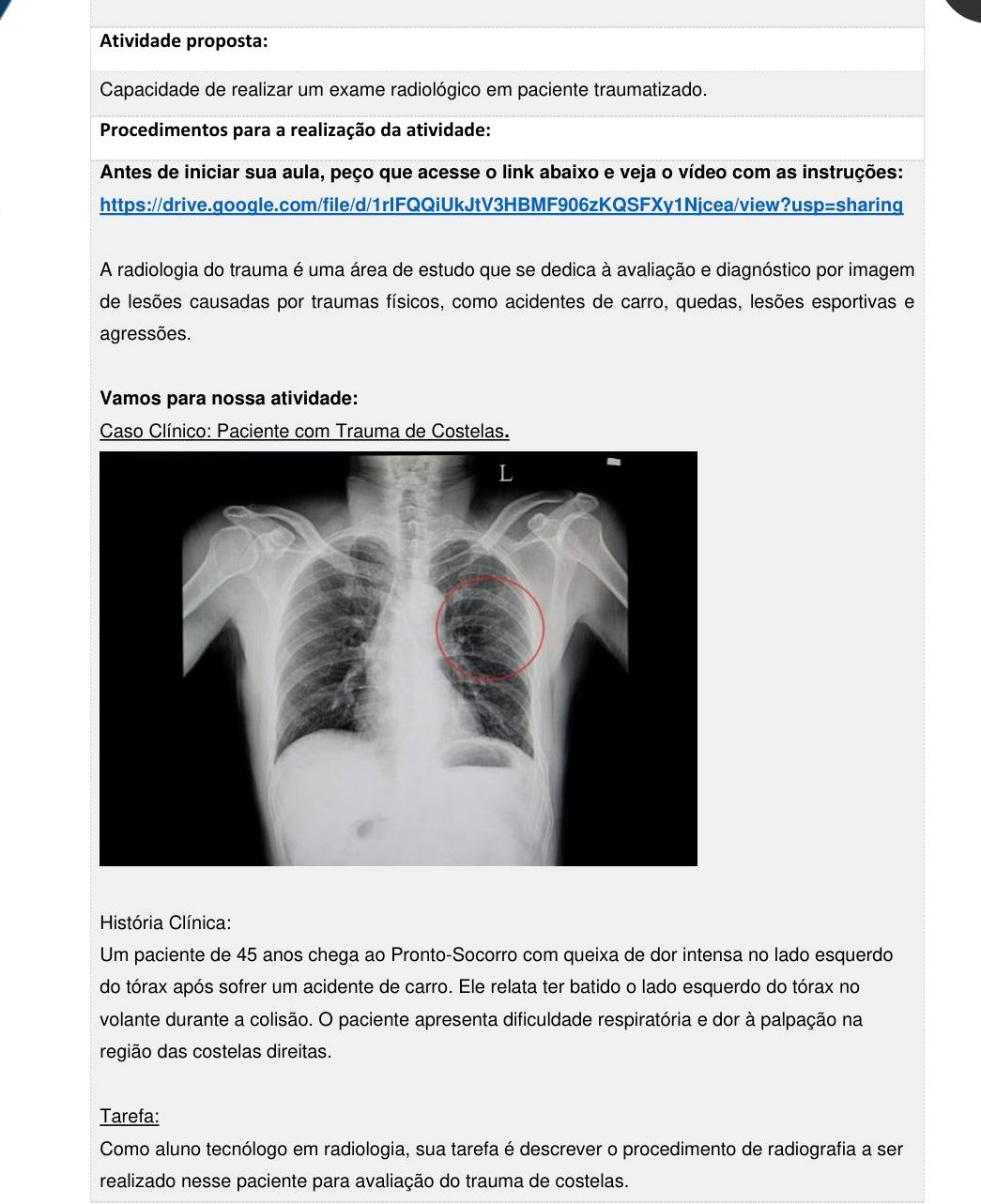 Atividade proposta: 
Capacidade de realizar um exame radiológico em paciente traumatizado. 
Procedimentos para a realização da atividade: 
Antes de iniciar sua aula, peço que acesse o link abaixo e veja o vídeo com as instruções: 
https://drive.google.com/file/d/1rIFQQiUkJtV3HBMF906zKQSFXy1Njcea/view?usp=sharing 
A radiologia do trauma é uma área de estudo que se dedica à avaliação e diagnóstico por imagem 
de lesões causadas por traumas físicos, como acidentes de carro, quedas, lesões esportivas e 
agressões. 
Vamos para nossa atividade: 
* Caso Clínico: Paciente com Trauma de Costelas. 
História Clínica: 
Um paciente de 45 anos chega ao Pronto-Socorro com queixa de dor intensa no lado esquerdo 
do tórax após sofrer um acidente de carro. Ele relata ter batido o lado esquerdo do tórax no 
volante durante a colisão. O paciente apresenta dificuldade respiratória e dor à palpação na 
região das costelas direitas. 
Tarefa: 
Como aluno tecnólogo em radiologia, sua tarefa é descrever o procedimento de radiografia a ser 
realizado nesse paciente para avaliação do trauma de costelas.