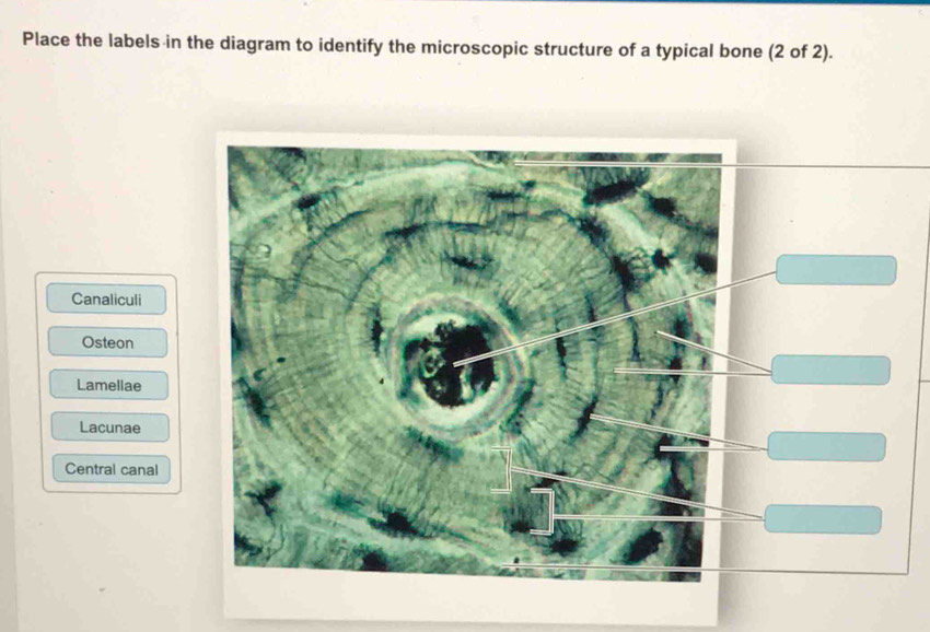 Place the labels in the diagram to identify the microscopic structure of a typical bone (2 of 2).
Canaliculi
Osteon
Lamellae
Lacunae
Central canal