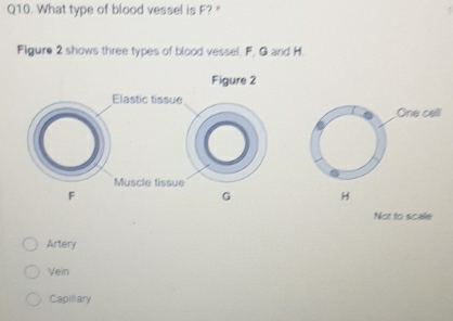 What type of blood vessel is F? * 
Figure 2 shows three types of blood vessel, F, G and H. 
Figure 2 
Elastic tissue 
Muscle tissue
F
G H
Not to scale 
Artery 
Vein 
Capiliary