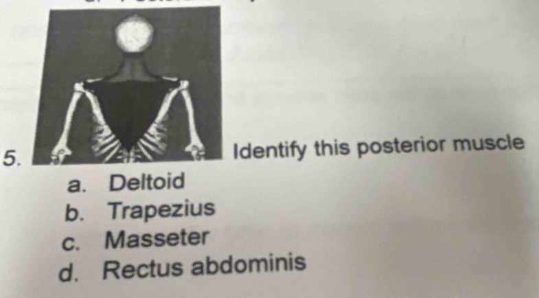 Identify this posterior muscle
a. Deltoid
b. Trapezius
c. Masseter
d. Rectus abdominis