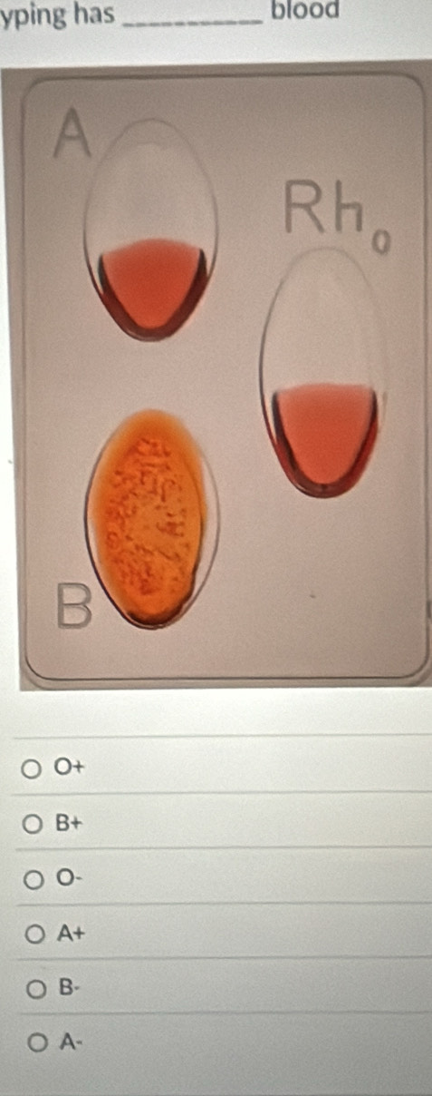 yping has _blood
O+
B+
0-
A+
B-
A-